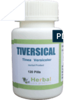 Tiversical For Tinea Versicolor Treatment
