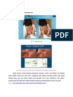 Thoracic Expansion