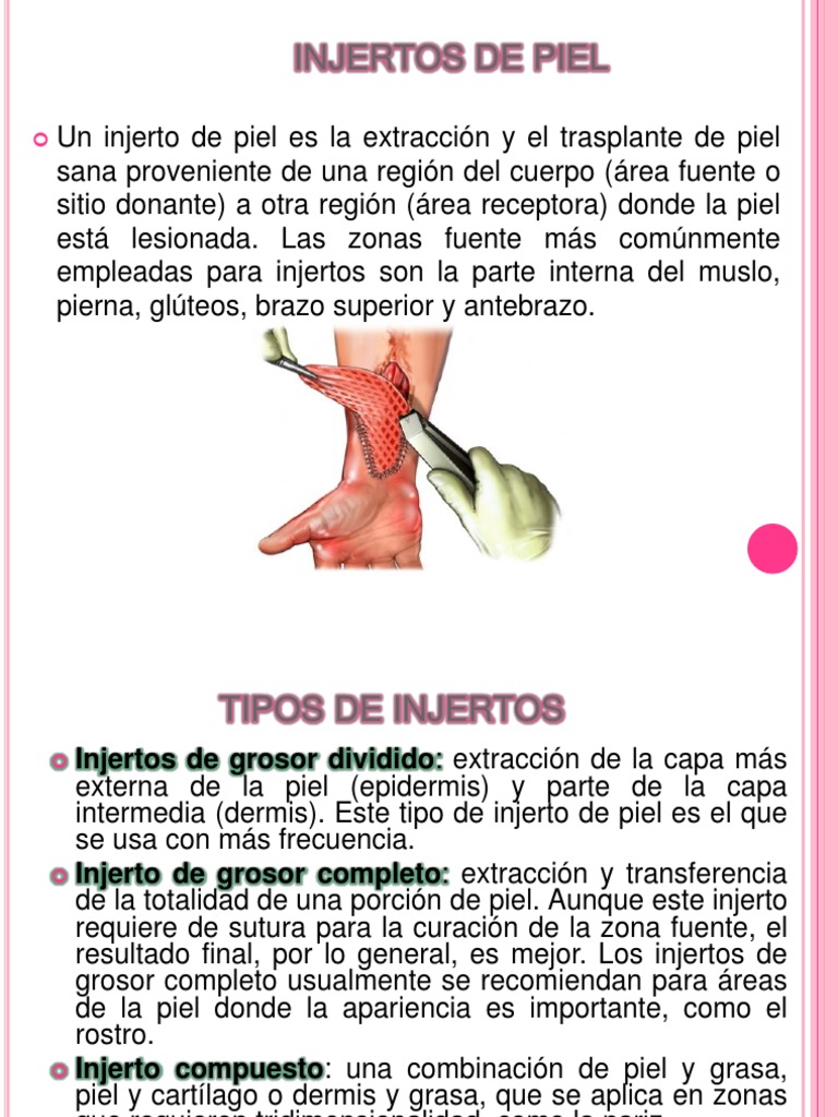 33 2R Principios Sobre Injertos y Colgajos Herida Piel