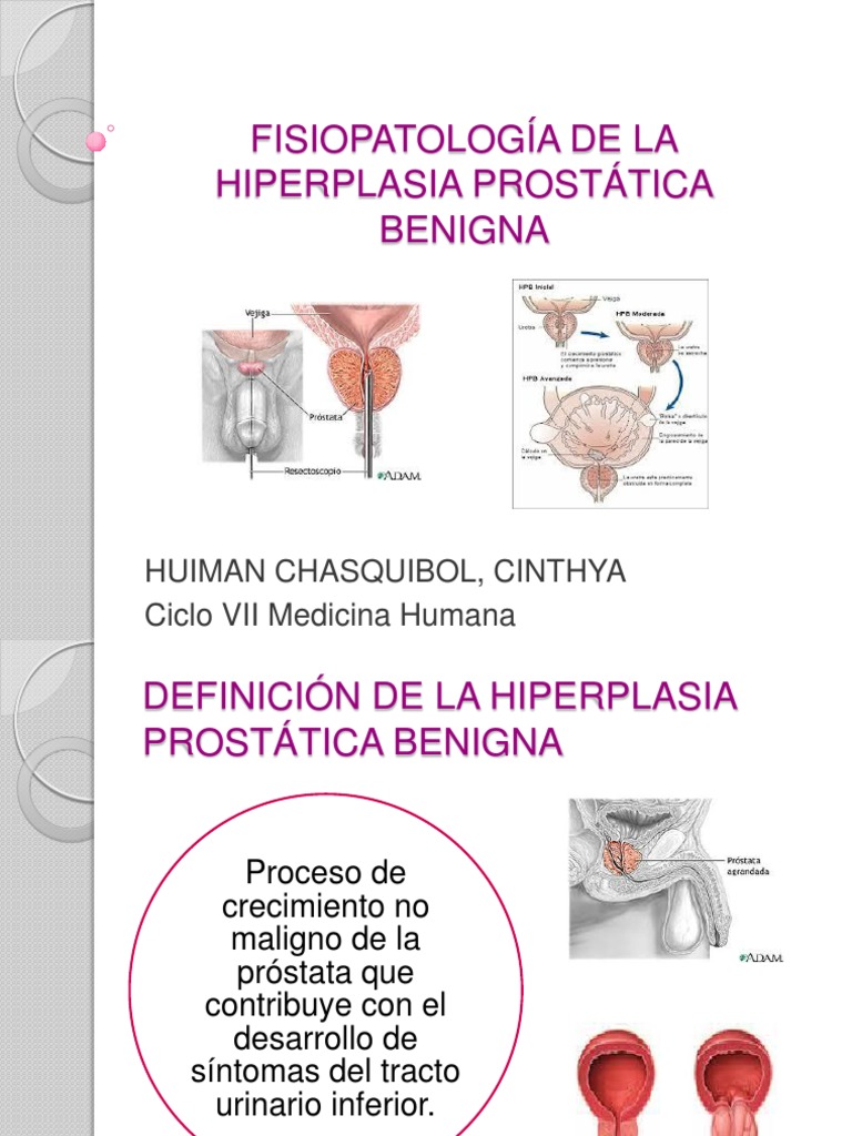 FISIOPATOLOGÍA DE LA HIPERPLASIA PROSTÁTICA BENIGNA Medicina Especialidades médicas