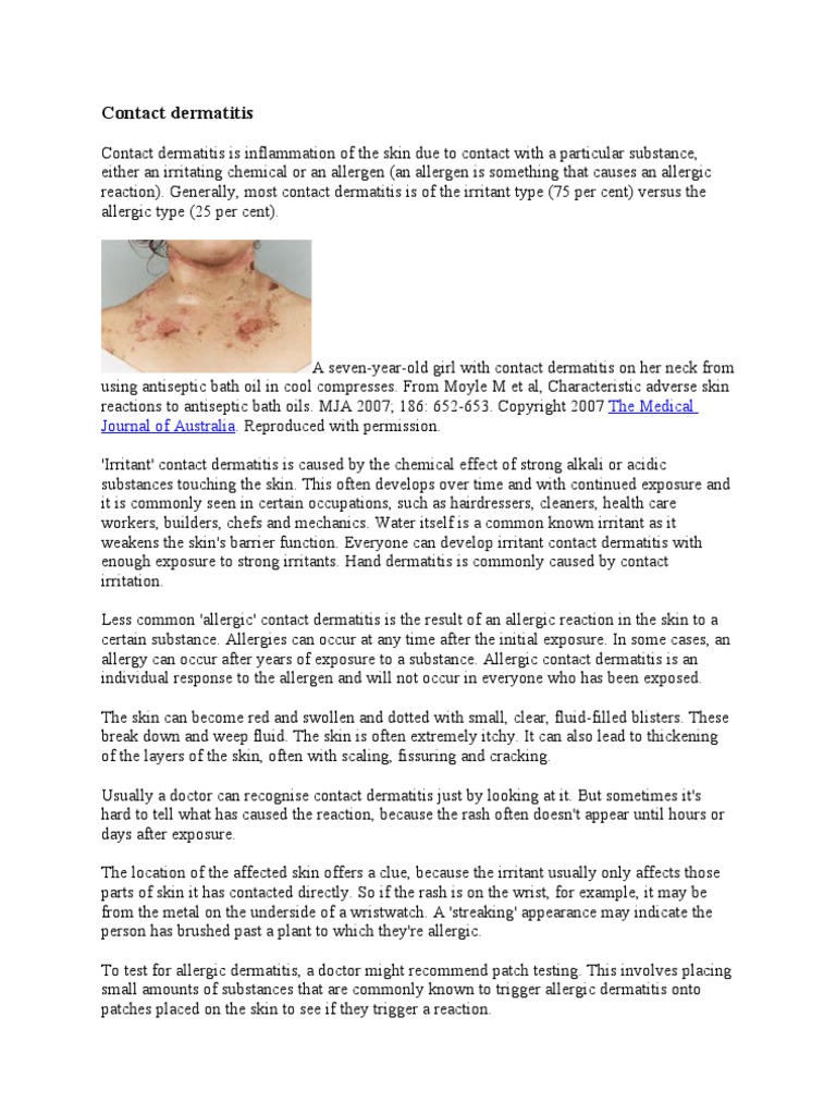 Dermatitis | PDF | Dermatitis | Allergy