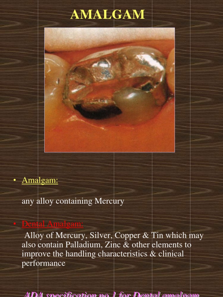 Amalgam Mercury (Element) Corrosion