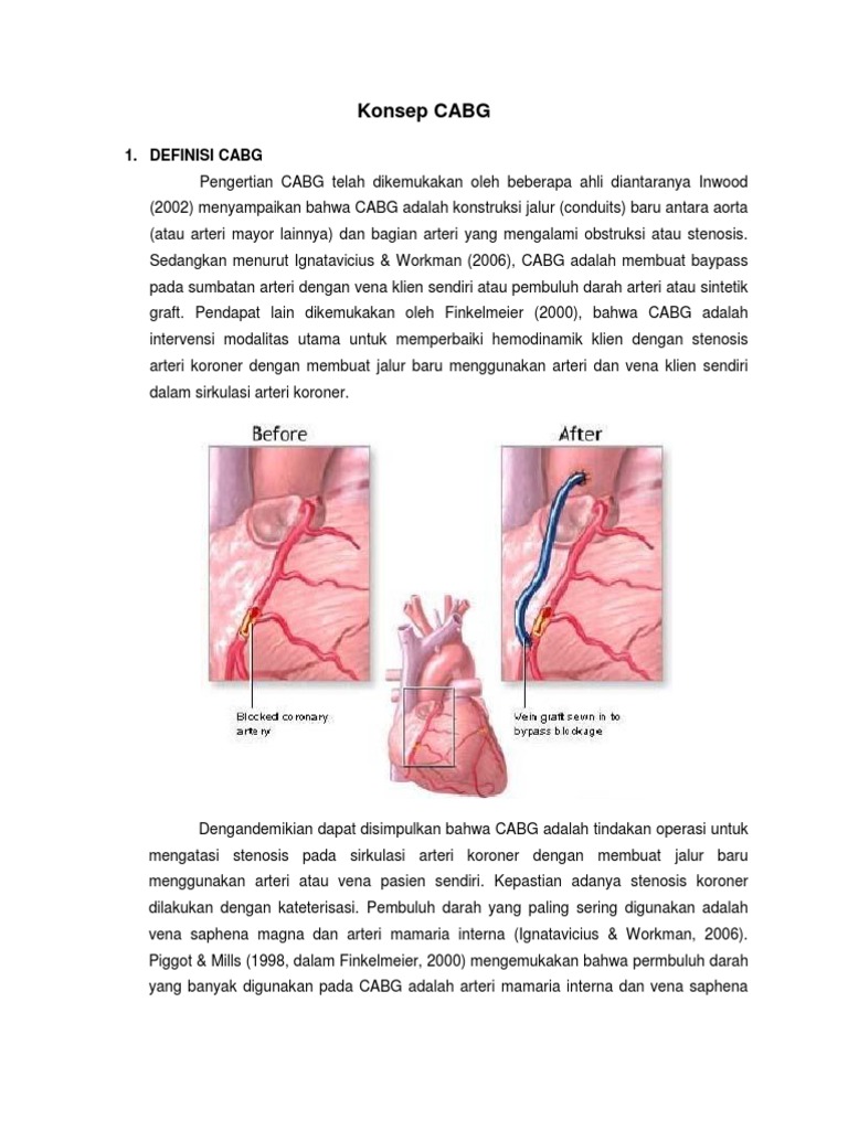 Prosedur dan Indikasi Tindakan CABG | PDF