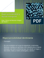 Microfiltracion, Hipersensibilidad y Ajuste Marginal