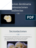 Preparacion Dentinaria de Restauraciones Indirectas