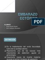 Embarazo Ectópico