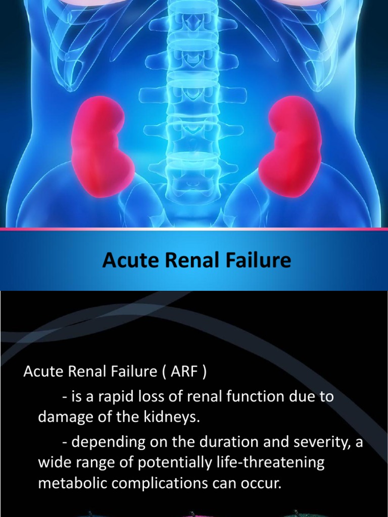 Acute Renal Failure Final | PDF | Renal Function | Kidney