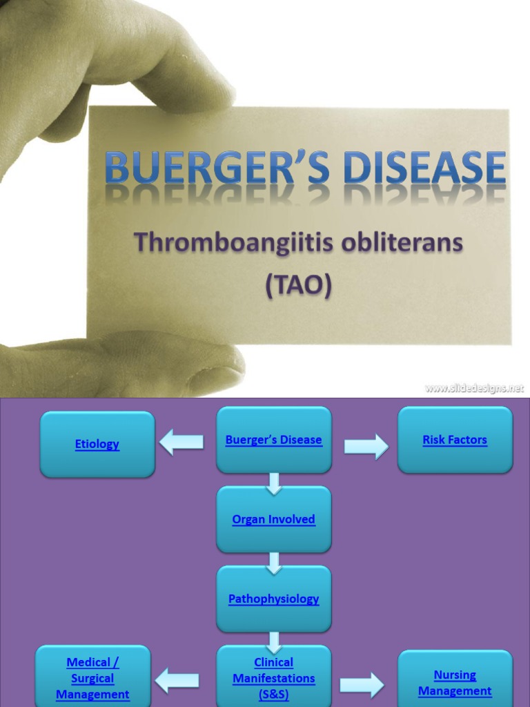 Buerger’s Disease