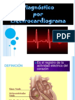 DX Ecg