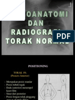 Radioanatomi Dan Radiografi Torak Normal