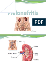 Pielonefritis Presentacion