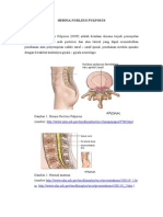 Hernia Diskus