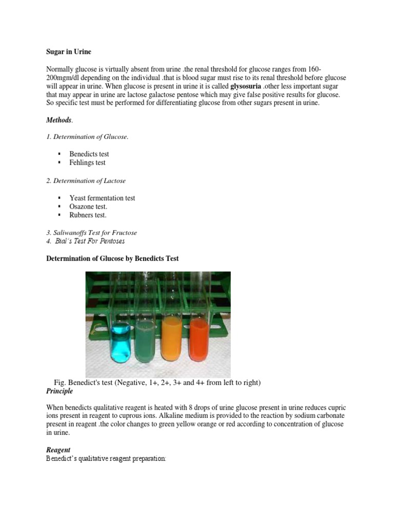 Sugar in Urine | Medical Specialties | Clinical Medicine