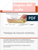 Patologías del codo: Epicondilitis y tendinopatías