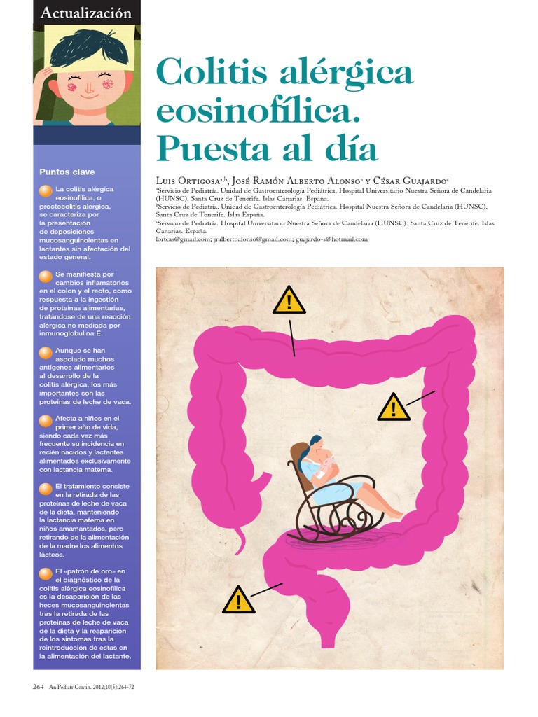 Proctocolitis alérgica en lactantes | PDF | Alergia | Amamantamiento