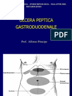 GEM Ulcera Peptica Gastroresecato
