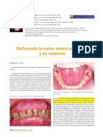 Caries