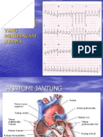 Ekg