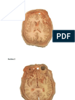 Cadaver Cross Sections Good