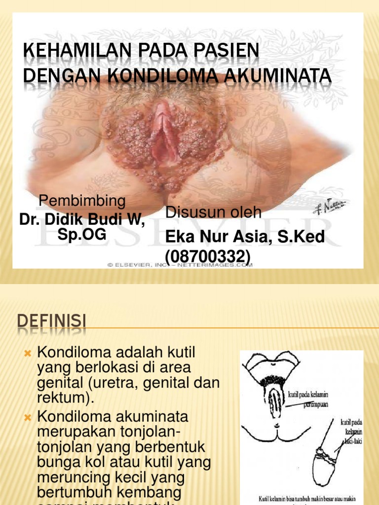 Vaginada kutilmagan yakun