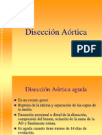 Disección Aórtica