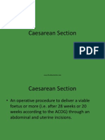 caesareansection