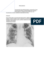 Fibrosis PulmonarRX