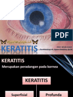 Keratitis Ninda