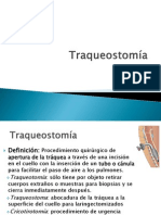 Traqueostomía