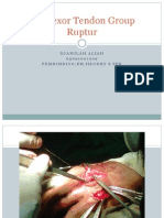 Old Flexor Tendon Group Ruptur