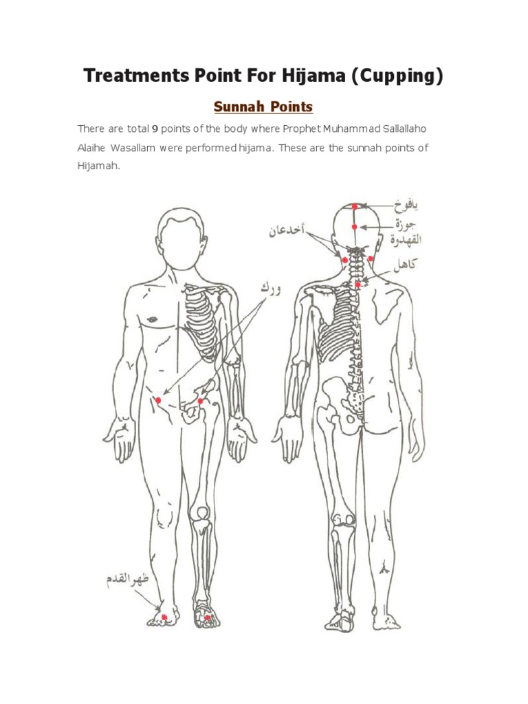 Hijama Cupping Treatment Points Pdf Menstruation Human Anatomy