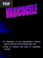 Varicocele