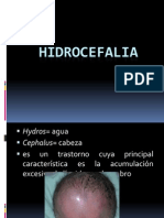 7 Hidrocefalia