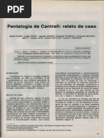 Pentalogia de Cantrell