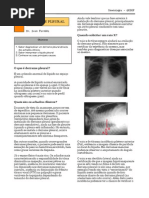 Derrame Pleural