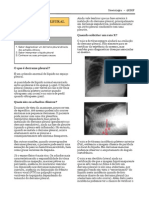 Derrame pleural: diagnóstico e tratamento