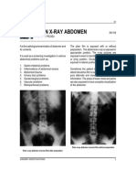 33309360 Plain Abdominal Xray