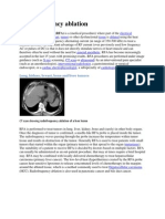 Radiofrequency Ablation