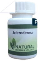 Natural Herbal Treatment For Scleroderma