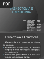 Frenectomia+e+Frenotomia