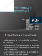Frenectomia+e+Frenotomia
