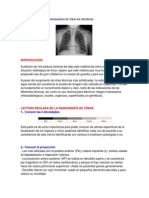 Interpretación de Las Radiografías de Tórax en Urgencias