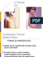 1239825338856leishmaniose Visceral Quadro Clnico