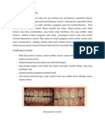 Hipomaturasi Enamel