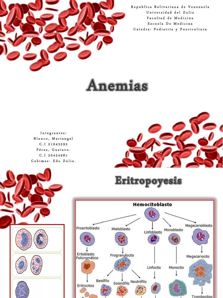 Anemia Finalizado | PDF | Ácido fólico | Dieta y nutrición