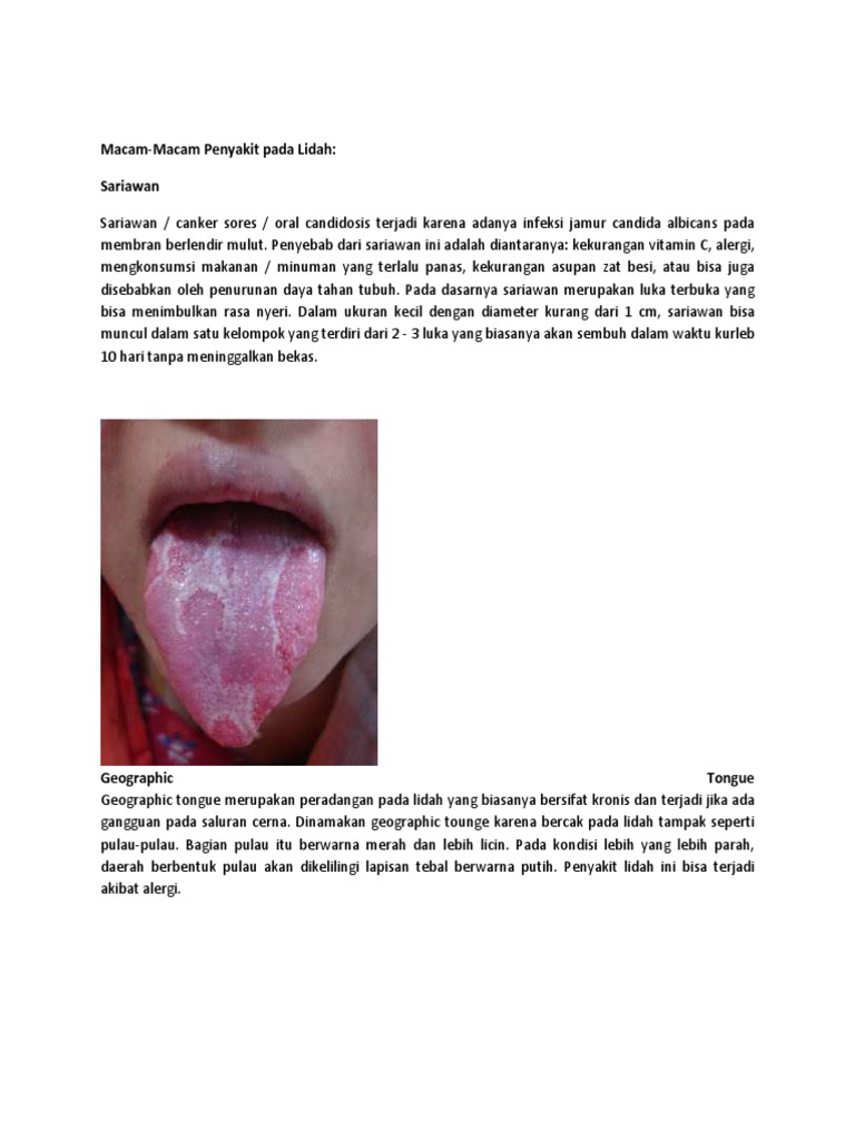 Macam Macam Penyakit Dari Lidah Pdf