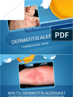 Dermatitis Alergika