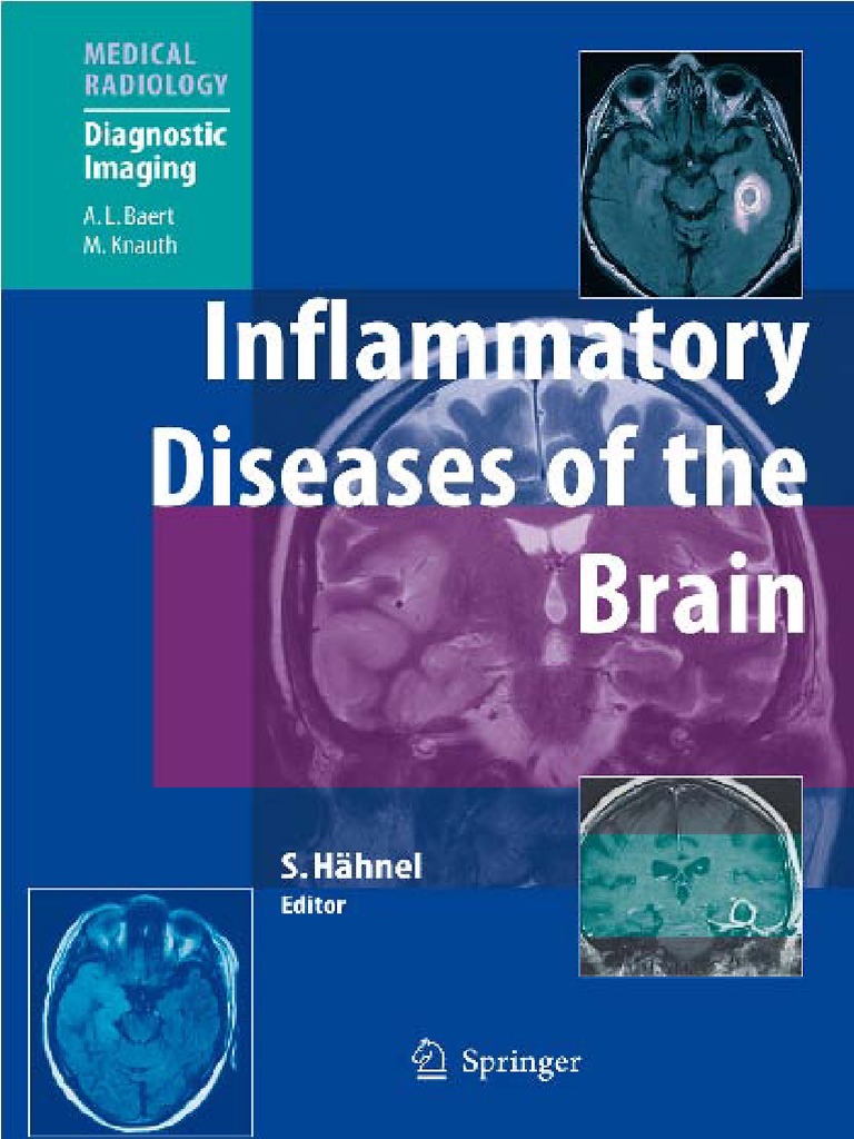 Inflammatory Diseases of the Brain Multiple Sclerosis