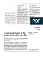 Tranmucosal Fixation Edentulous Mand Fx