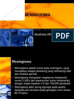 Meningioma